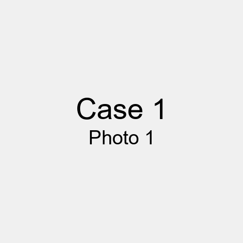 #Case_Case 1