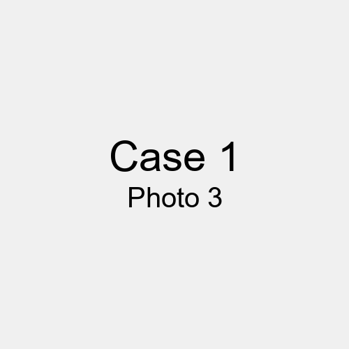 #Case_Case 1