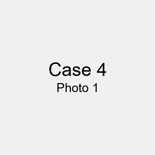 #Case_Case 4