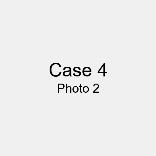 #Case_Case 4