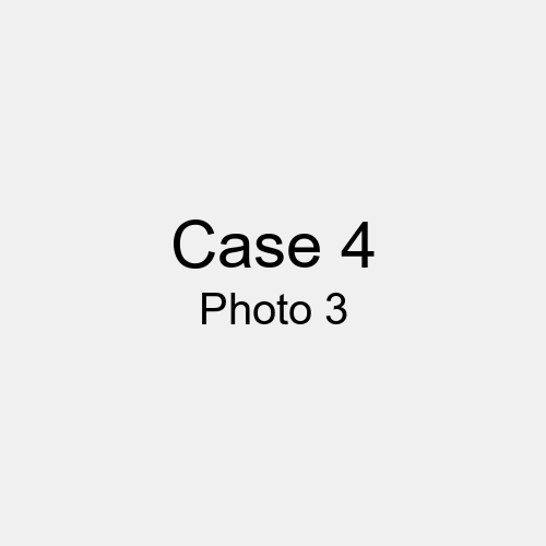 #Case_Case 4