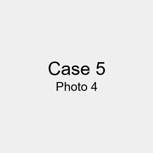 #Case_Case 5