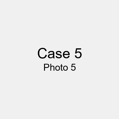 #Case_Case 5