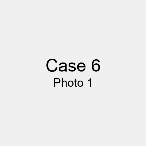 #Case_Case 6