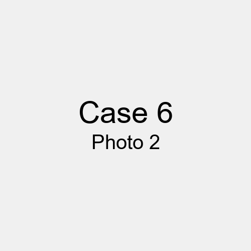 #Case_Case 6