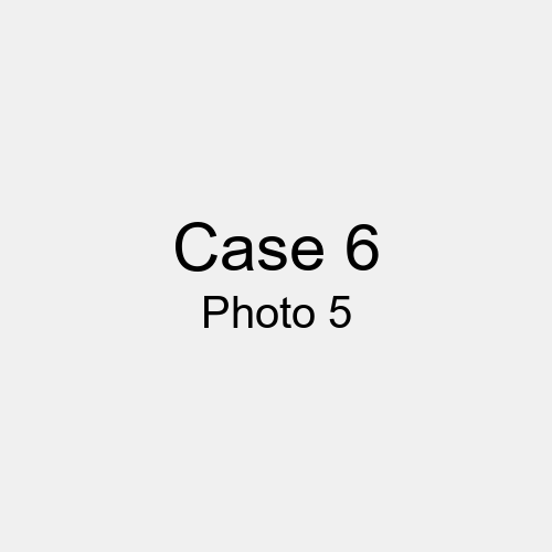 #Case_Case 6