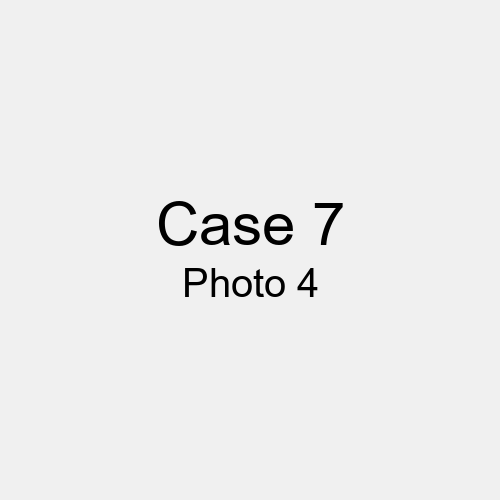 #Case_Case 7