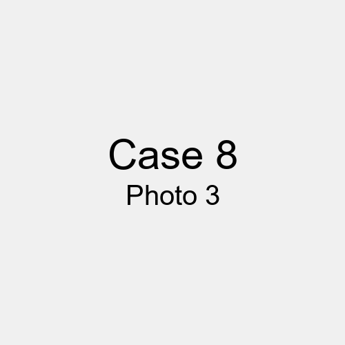 #Case_Case 8