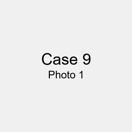 #Case_Case 9