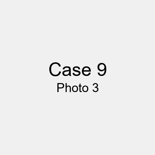 #Case_Case 9