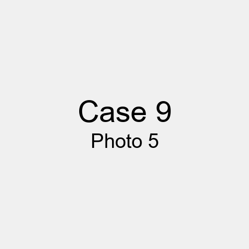 #Case_Case 9